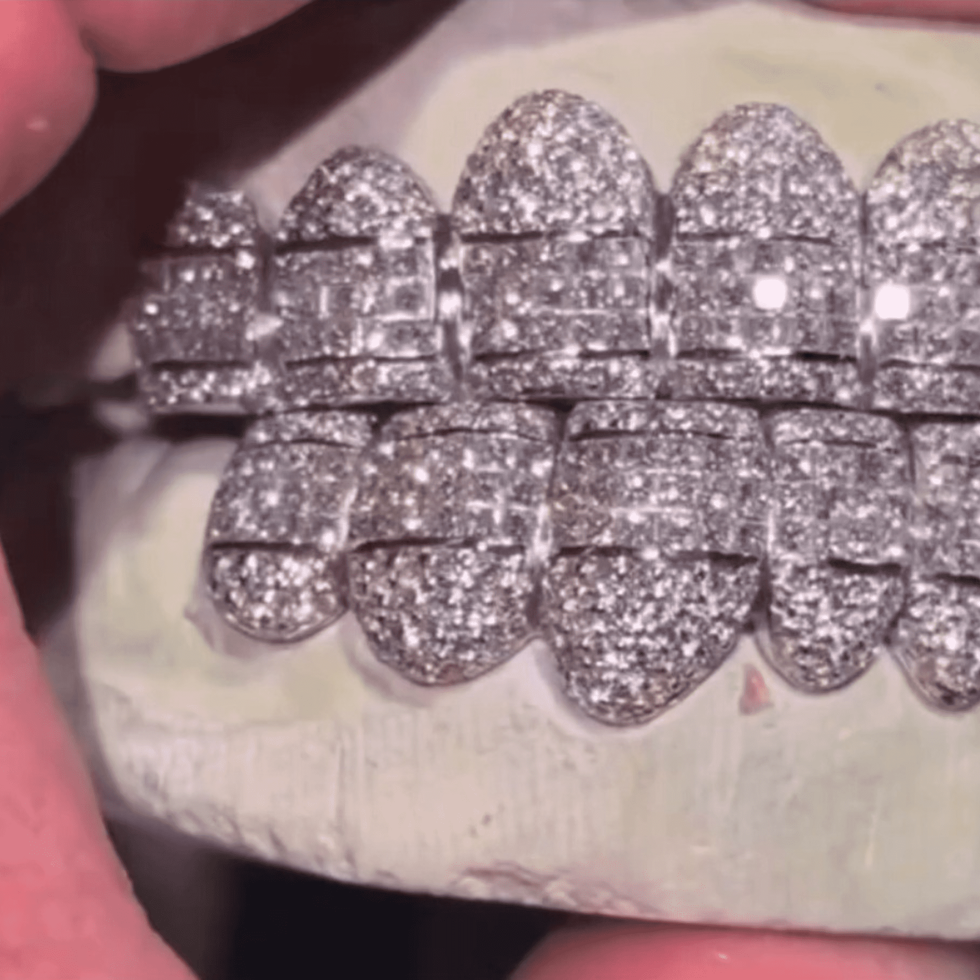 Double Row Iced Out Teeth Grillz – Maximum Shine Custom Fit Mouthpiece - Image 7