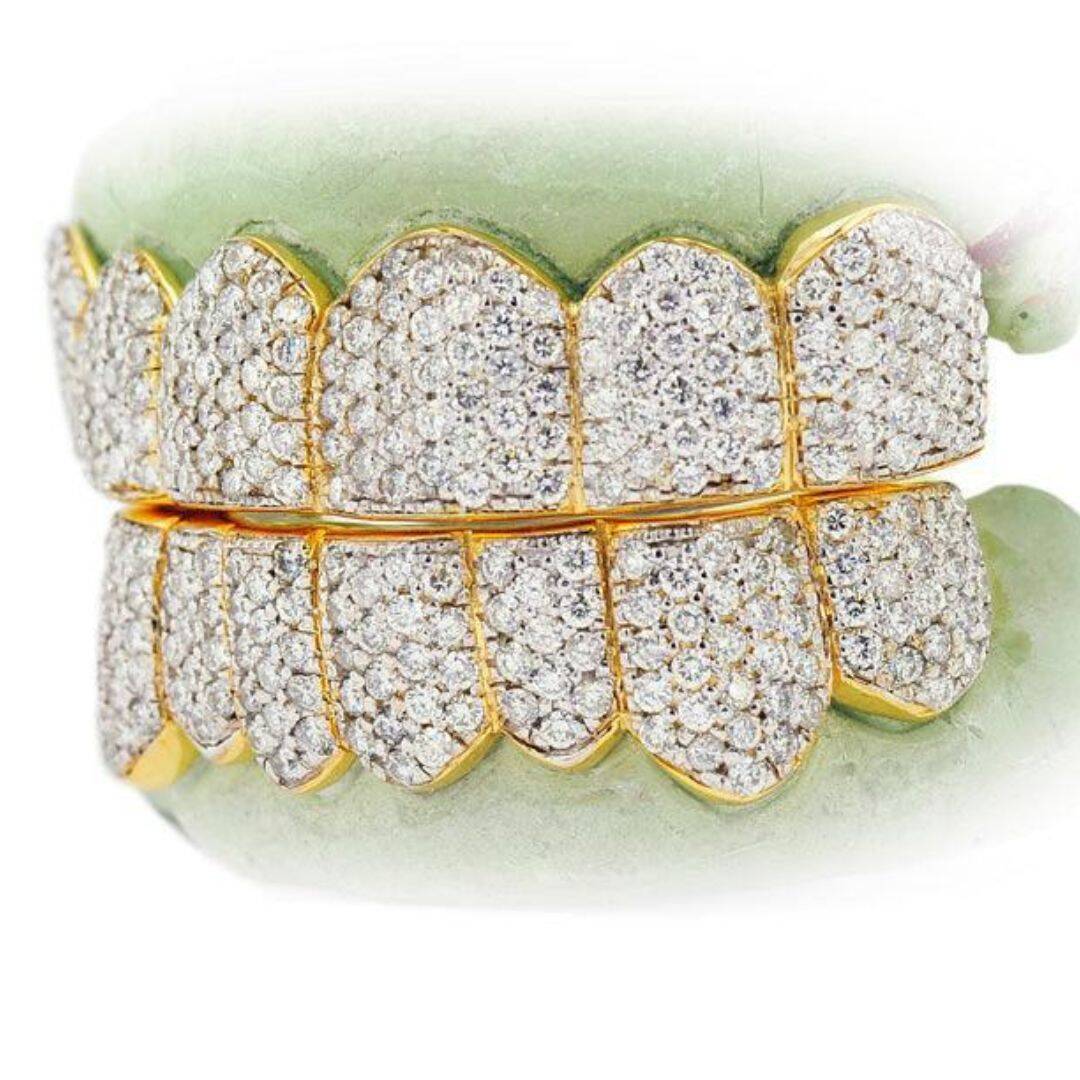 Diamond Teeth