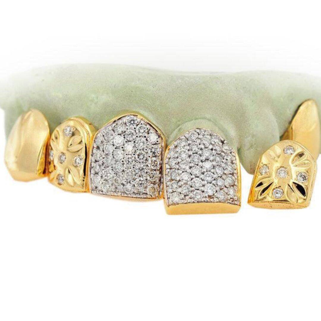 Diamond Grillz on Teeth