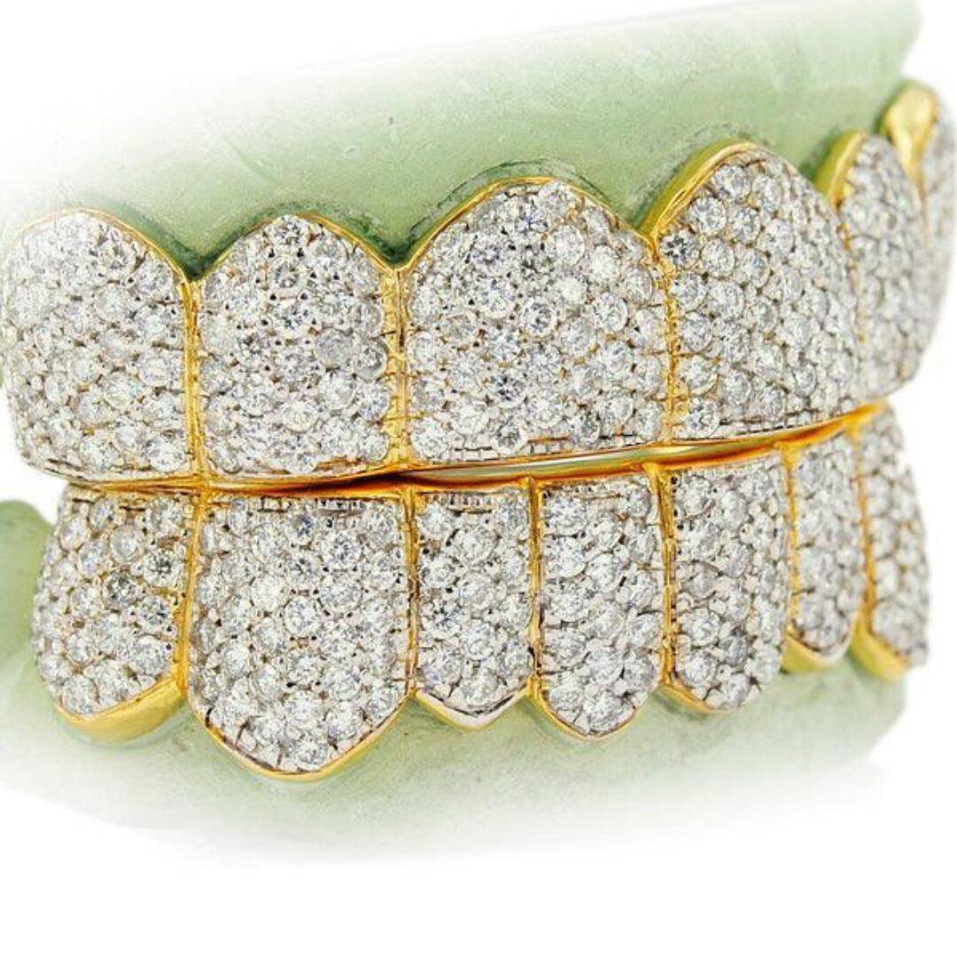 Diamond Teeth