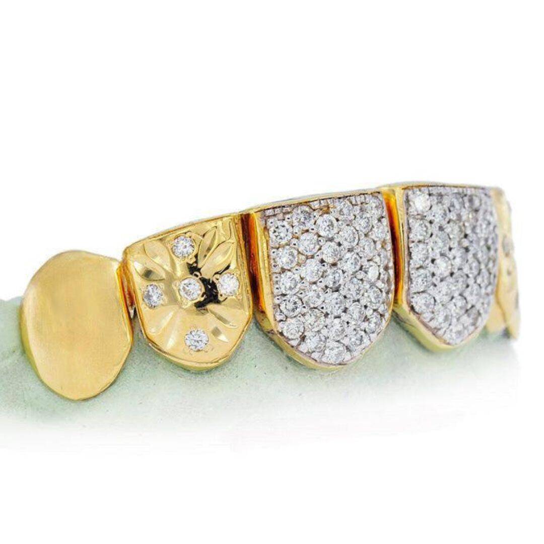 Diamond Grillz on Teeth