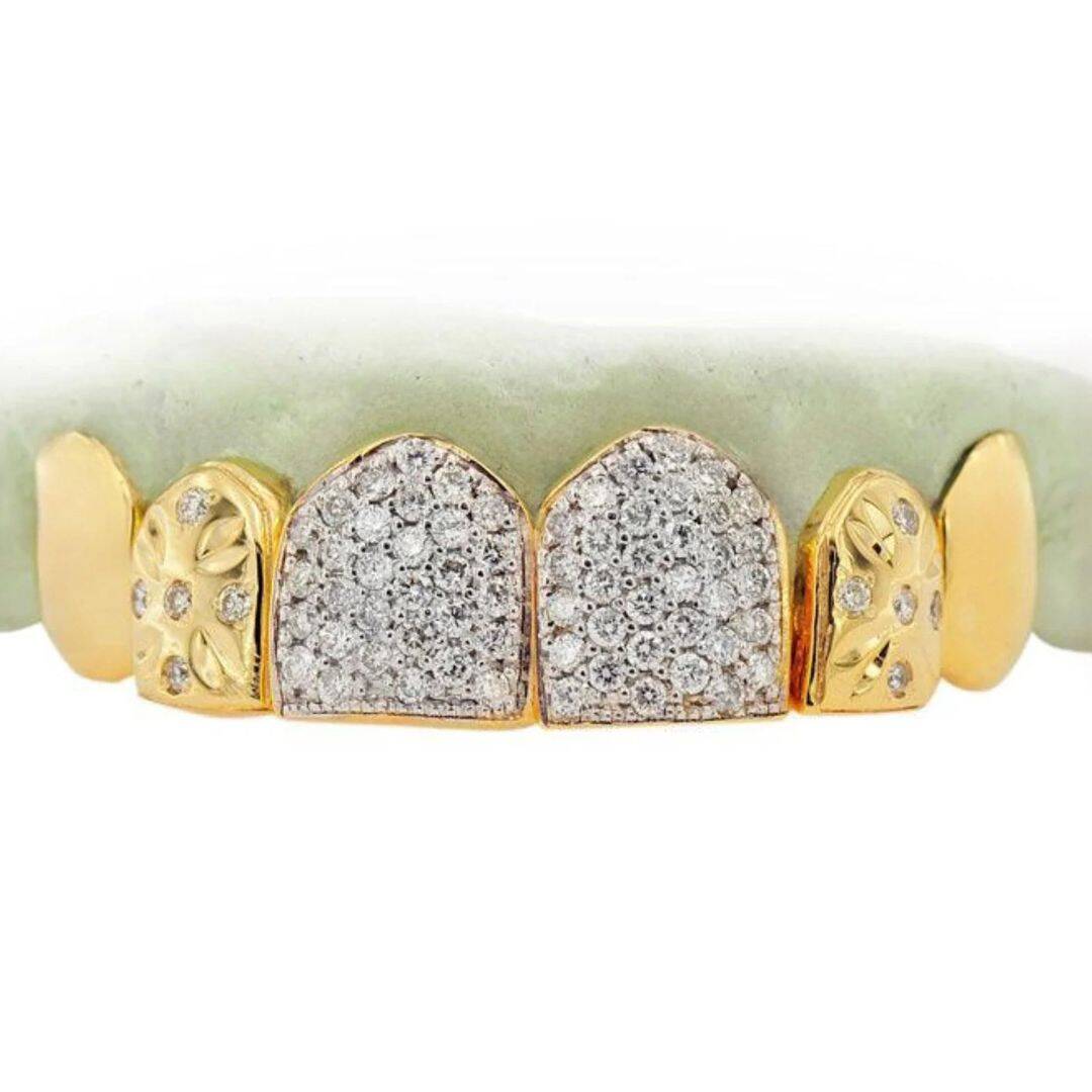 Diamond Grillz on Teeth