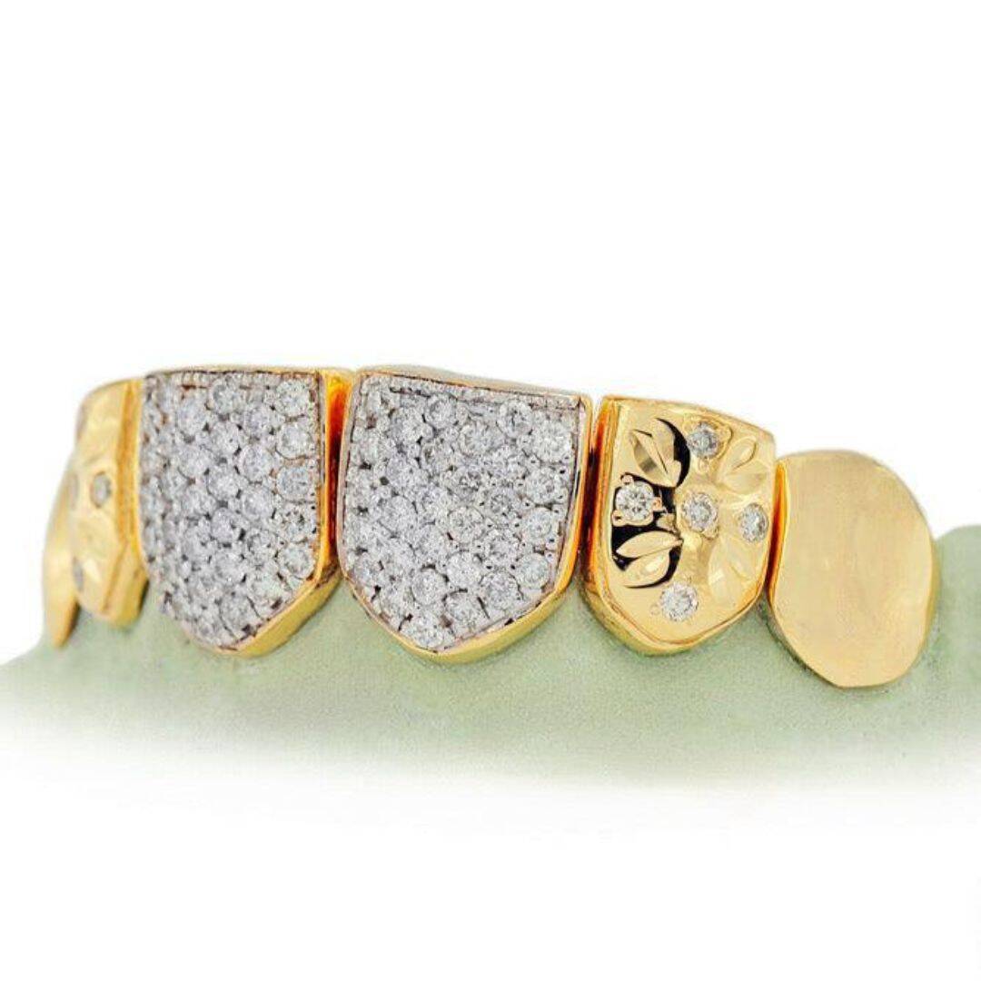 Diamond Grillz on Teeth
