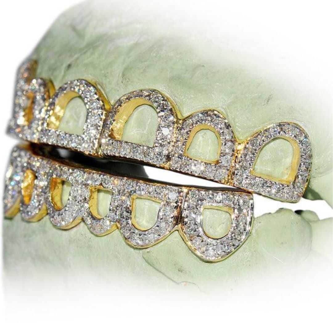 Diamond Grillz on Teeth