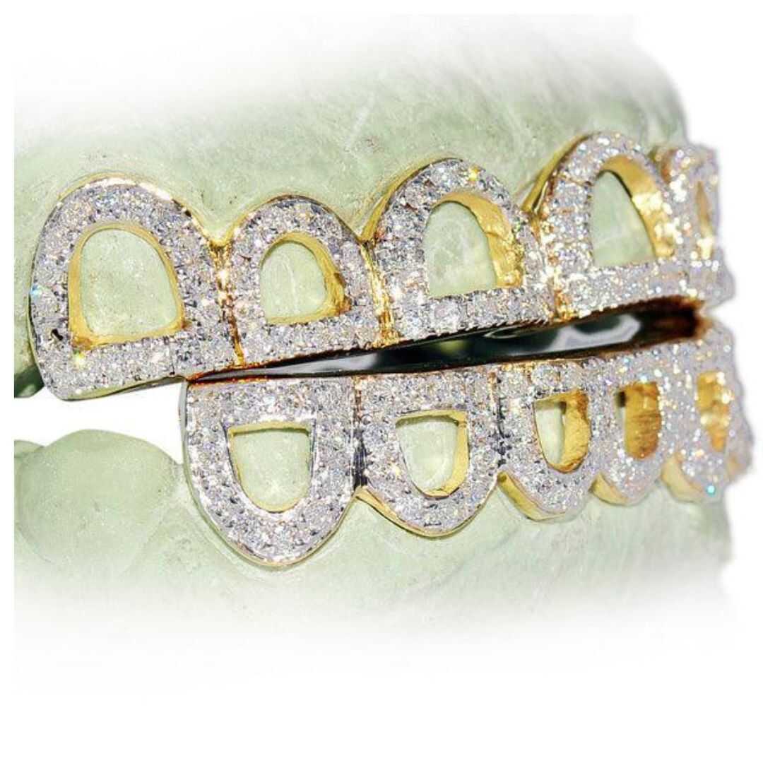 Diamond Grillz on Teeth