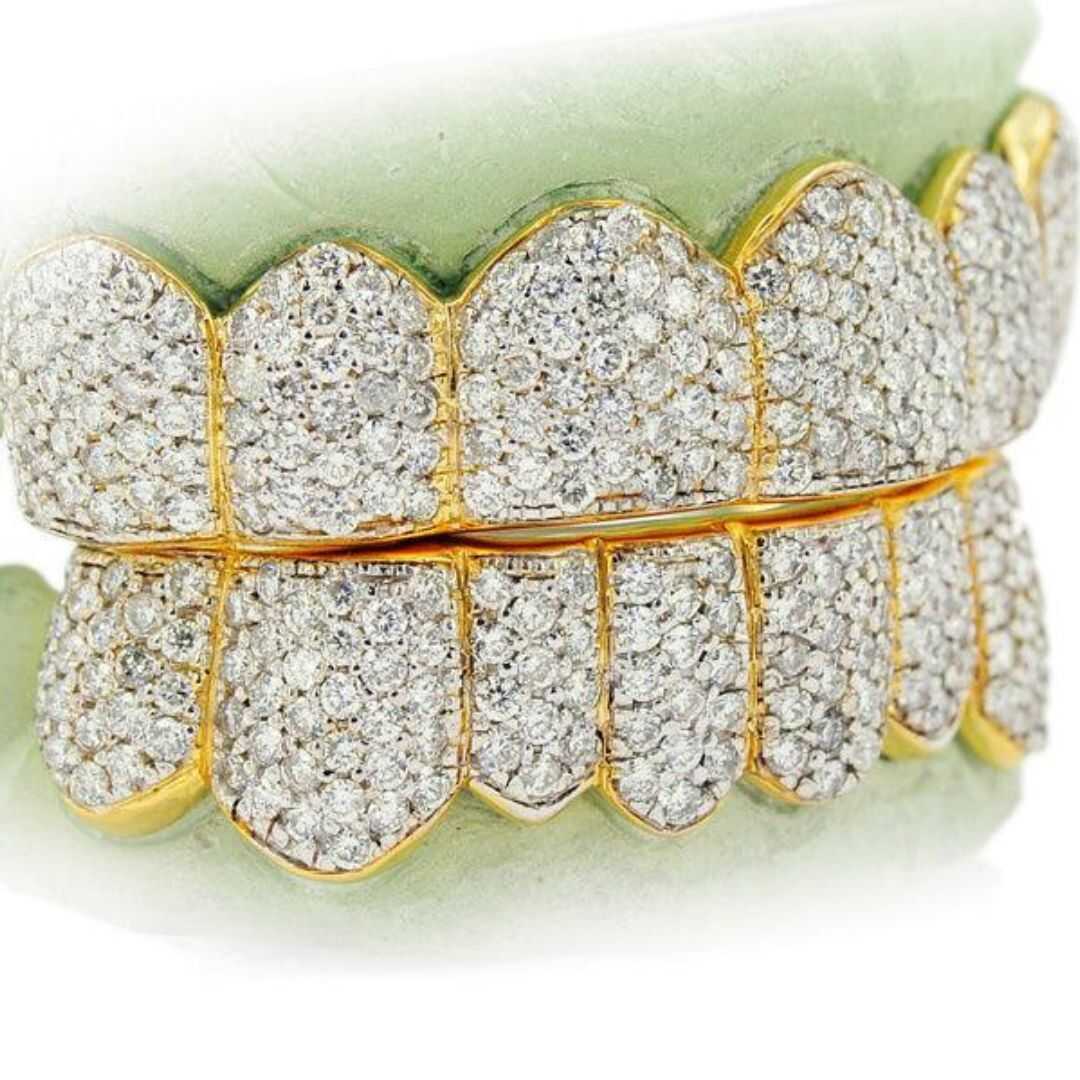 Diamond Teeth