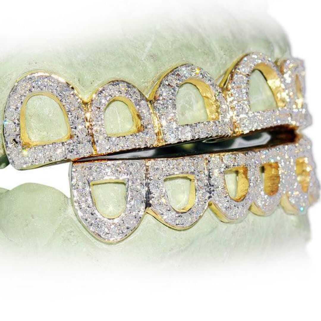 Diamond Grillz on Teeth